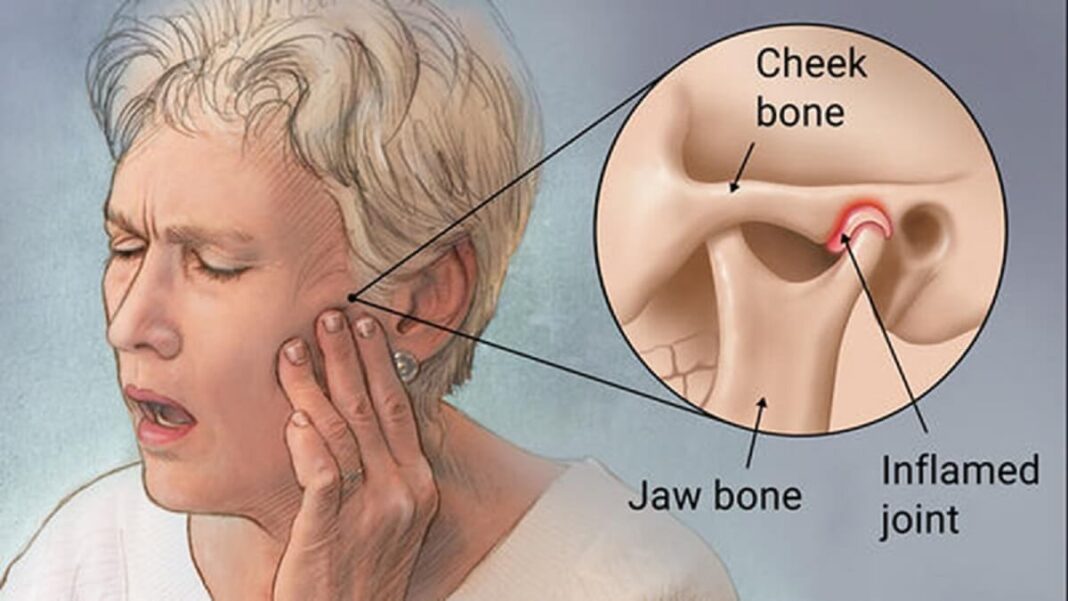 What is TMJ, and How Can a Dentist Assist With It