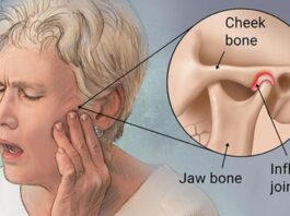 What is TMJ, and How Can a Dentist Assist With It