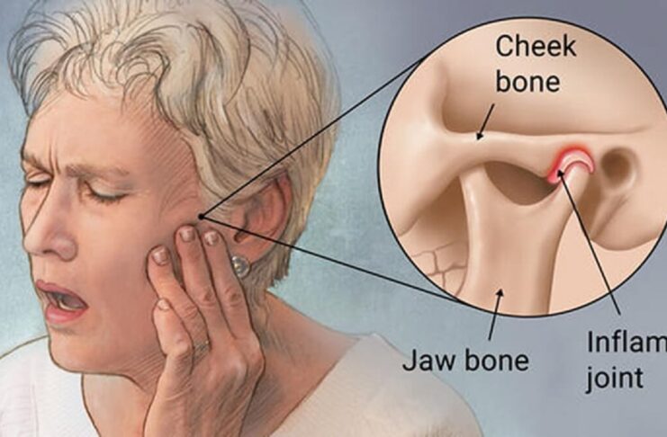 What is TMJ, and How Can a Dentist Assist With It